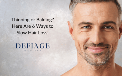 Thinning or Balding? Here Are 6 Ways to Slow Hair Loss!